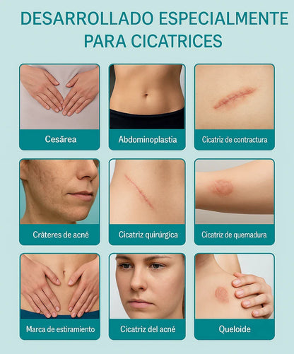 ScarRemove™ Elimina cicatrices y regenera desde el primer uso
